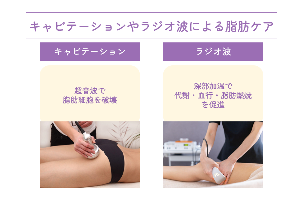 キャビテーションやラジオ波による脂肪ケア