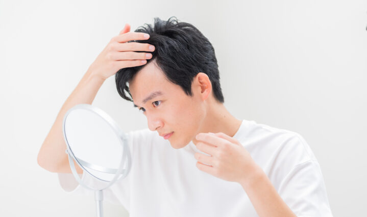 男性の薄毛