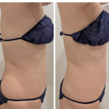 側面 ウエスト-3.5cm　下腹部-1cm