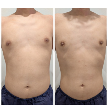 正面 ウエスト−3cm