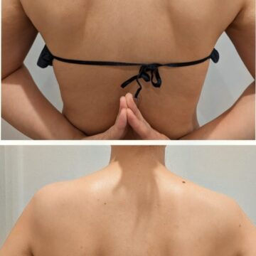 背中のBeforeAfter。背中・肩甲骨周りがスッキリし、背中のドレスラインが綺麗に。