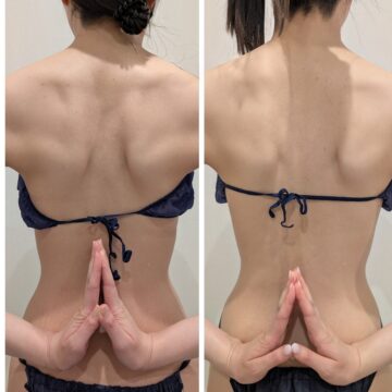 背中BeforeAfter。肩甲骨周りがスッキリ