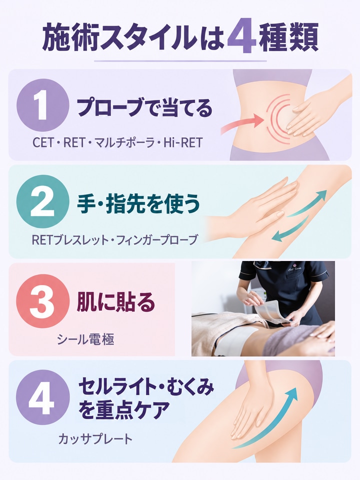 施術スタイル別に見るパーツの分類を整理した図（カッサプレートはセルライト・むくみを重点ケア）