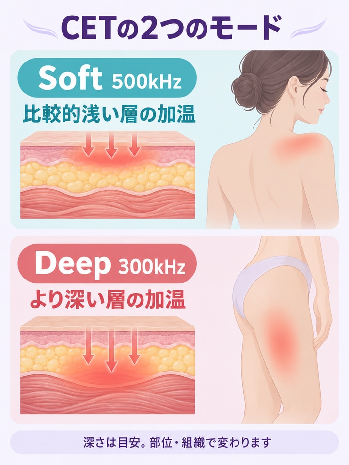 CETエレクトロードとは？ SoftとDeepで変わる届く深さを整理した図