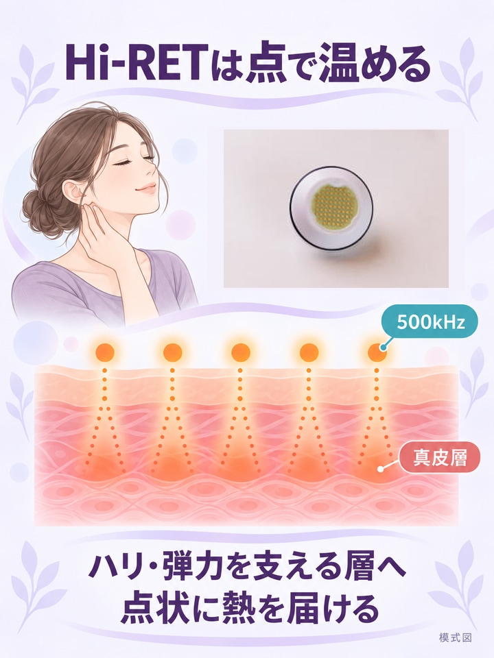 Hi-RETとは？ 格子状に熱を届ける仕組みを実物写真と図解で整理したインフォグラフ