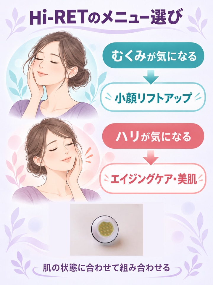 Hi-RETを使うおすすめメニューを実物写真と図解で整理したインフォグラフ